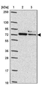 Lane 1: Marker [kDa] 250, 130, 95, 72, 55, 36, 28, 17, 10_br/_Lane 2: Human cell line RT-4_br/_Lane 3: Human cell line U-251MG sp