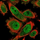 Immunofluorescent staining of human cell line PC-3 shows localization to nucleoplasm & cytosol.