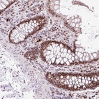 Anti-CCNL2 Antibody