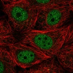 Immunofluorescent staining of human cell line MCF7 shows localization to nucleoplasm.