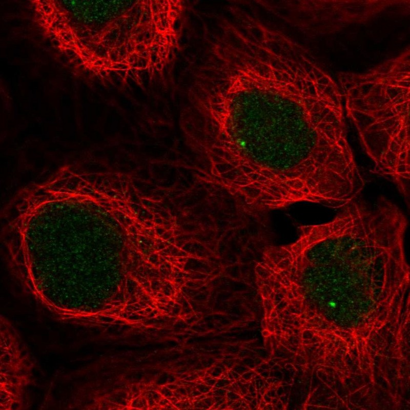 Anti-SNAPC3 Antibody