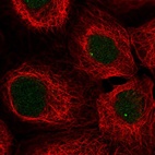 Anti-SNAPC3 Antibody