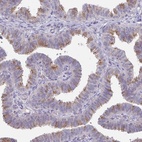 Anti-DCAF12L2 Antibody