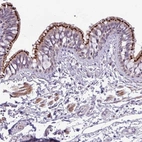 Anti-SPINK8 Antibody