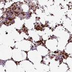 Immunohistochemical staining of human bone marrow shows strong cytoplasmic positivity in hematopoietic cells.