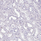 Anti-EXOSC5 Antibody