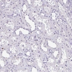 Immunohistochemical staining of human kidney shows no positivity in cells in tubules as expected.