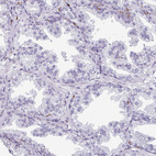 Immunohistochemical staining of human prostate shows no positivity in glandular cells as expected.