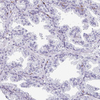 Anti-EXOSC5 Antibody