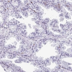 Immunohistochemical staining of human prostate shows no positivity in glandular cells as expected.