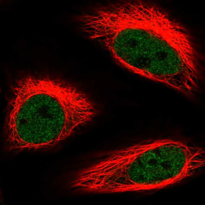 Anti-HMG20B Antibody