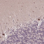 Immunohistochemical staining of human cerebellum shows strong nuclear positivity in Purkinje cells.
