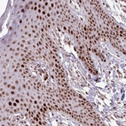 Immunohistochemical staining of human skin shows strong nuclear positivity in squamous epithelial cells.