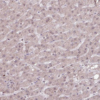 Anti-ZNF709 Antibody