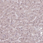 Immunohistochemical staining of human liver shows no positivity in hepatocytes as expected.