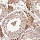 Anti-TCL1B Antibody