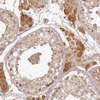 Anti-TCL1B Antibody
