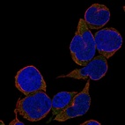 Immunofluorescent staining of human cell line REH shows localization to cytosol.