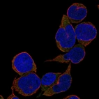 Immunofluorescent staining of human cell line REH shows localization to cytosol.