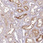 Anti-CTXN2 Antibody