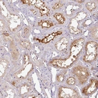 Anti-CTXN2 Antibody