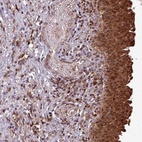 Anti-OR6B1 Antibody