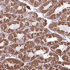 Anti-ZCCHC5 Antibody