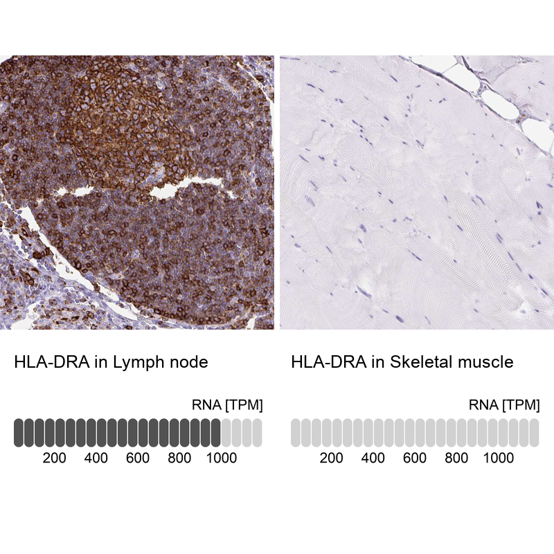 Anti-HLA-DRA Antibody