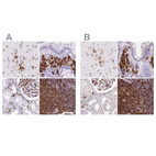 Immunohistochemical staining of human cerebral cortex, colon, kidney and lymph node using Anti-HLA-DRA antibody HPA053176 (A) shows similar protein distribution across tissues to independent antibody HPA050162 (B).