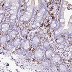 Immunohistochemical staining of human small intestine shows positivity in lymphoid cells.