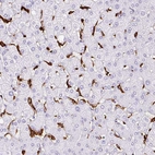 Immunohistochemical staining of human liver shows positivity in Kupffer cells.