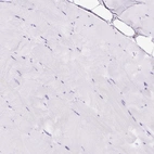 Immunohistochemical staining of human skeletal muscle shows no positivity in myocytes.