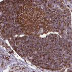 Immunohistochemical staining of human lymph node shows membranous positivity in lymphoid cells.