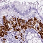 Immunohistochemical staining of human colon using Anti-HLA-DRA antibody HPA053176.