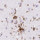 Immunohistochemical staining of human cerebral cortex using Anti-HLA-DRA antibody HPA053176.
