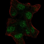 Anti-UBE2V1 Antibody