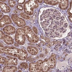 Anti-DCAF1 Antibody