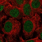 Immunofluorescent staining of human cell line CACO-2 shows localization to nucleus & nucleoli fibrillar center.