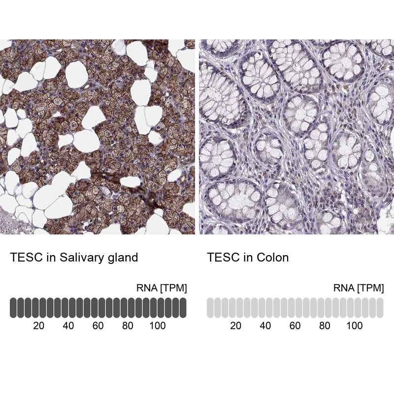 Anti-TESC Antibody