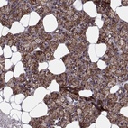 Immunohistochemical staining of human salivary gland shows high expression.