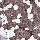 Immunohistochemical staining of human salivary gland shows high expression.