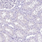 Immunohistochemical staining of human kidney shows no positivity in cells in tubules and cells in glomeruli as expected.