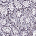 Immunohistochemical staining of human colon shows low expression as expected.