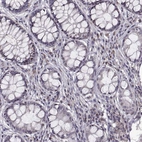 Immunohistochemical staining of human colon shows low expression as expected.