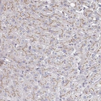 Immunohistochemical staining of human liver shows moderate positivity in bile canaliculi.