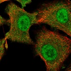 Immunofluorescent staining of human cell line A549 shows localization to nucleoplasm & cytosol.