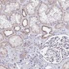 Immunohistochemical staining of human kidney shows moderate to strong positivity in Golgi apparatus in cells in tubules.