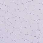 Immunohistochemical staining of human skeletal muscle shows no cytoplasmic positivity in myocytes as expected.