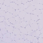 Immunohistochemical staining of human skeletal muscle shows no cytoplasmic positivity in myocytes as expected.