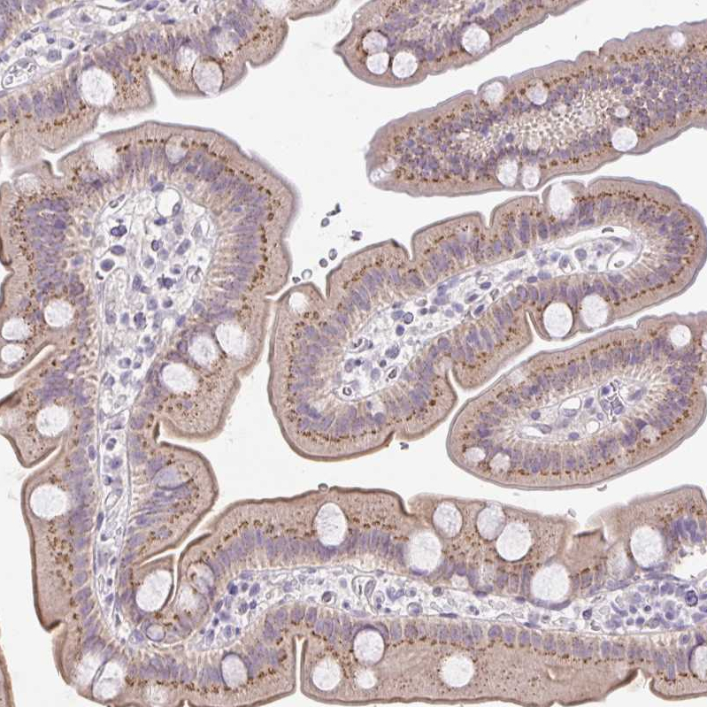 Anti-FAM177A1 Antibody